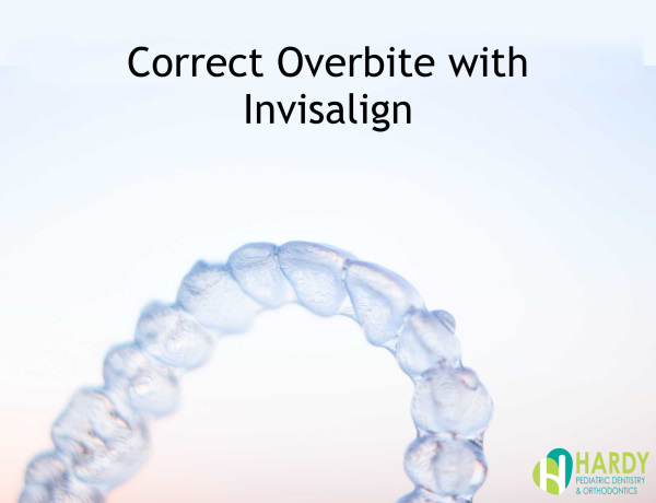 How Can Invisalign Correct Overbite - Hardy Pediatric Dentistry