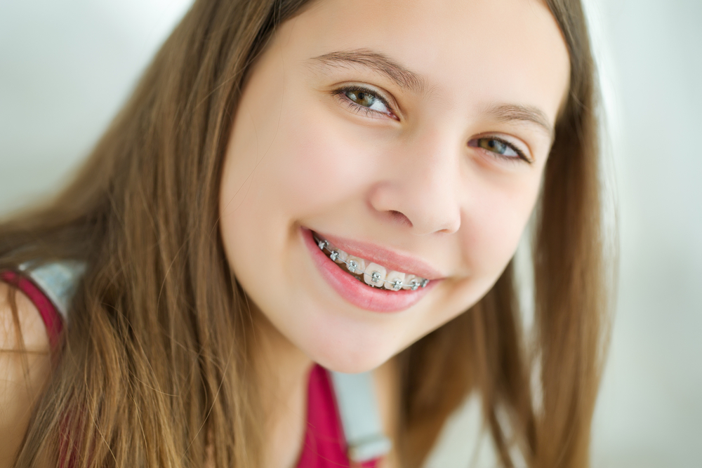 Kids Braces  Why is Early Dental Intervention Important?